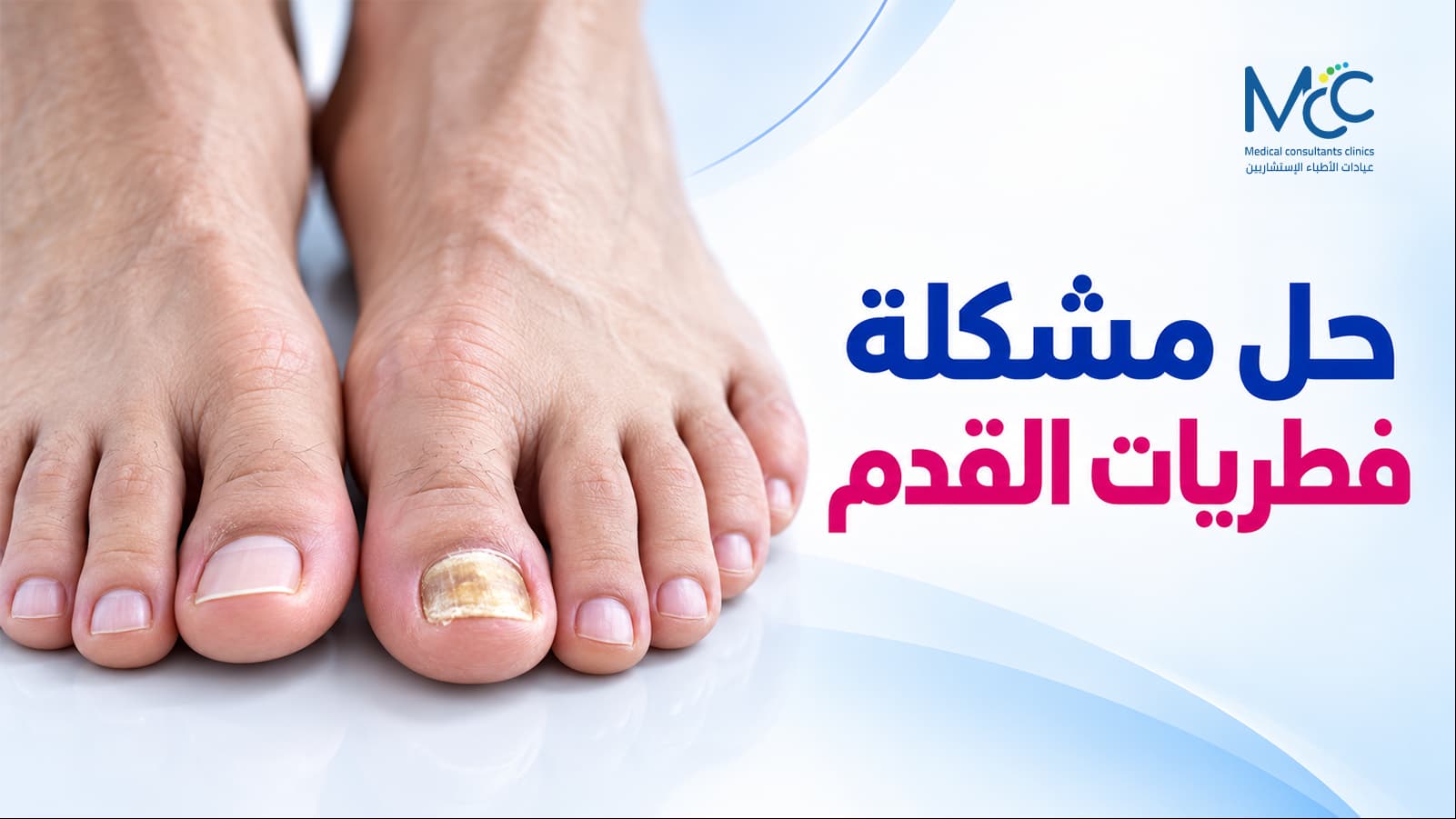 فطريات القدم
