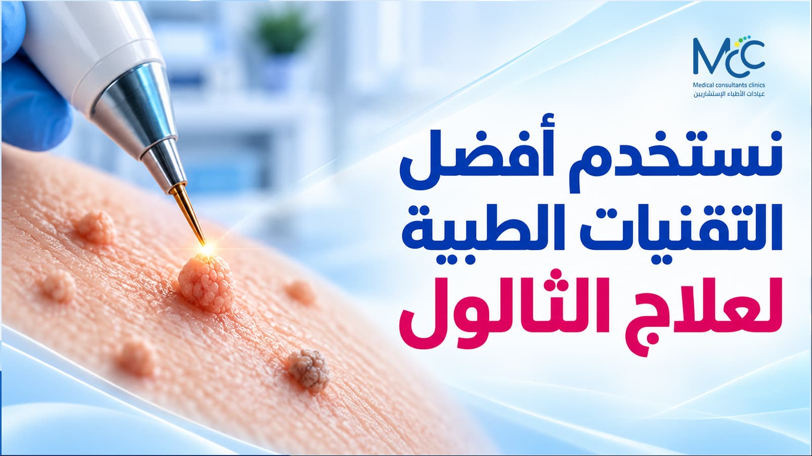 علاج الثالول